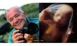 Nhiếp ảnh gia dành 12 năm chụp quá trình phát triển của em bé trong bụng mẹ, ai xem cũng rung động