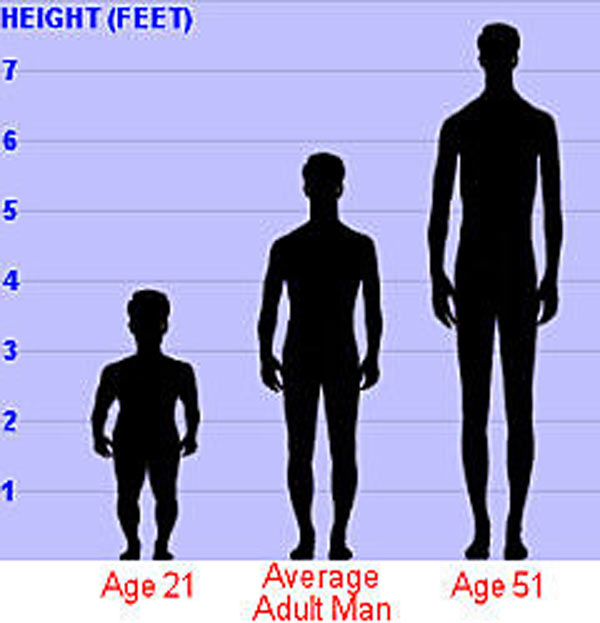Người đàn ông vừa lùn vừa cao 'độc nhất vô nhị' trong lịch sử y học